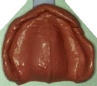 zUpper impression, Red wax bite, shipping