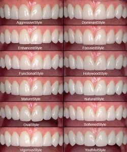zBleach Anterior Teeth with shipping