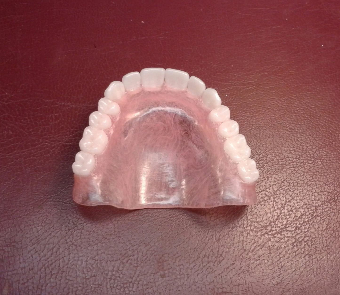 zUpper ultra-thin denture, Lower flexible partial, Bleach shade teeth, Wax try-in, New upper/lower impressions, shipping (x2) Balance Owed 2