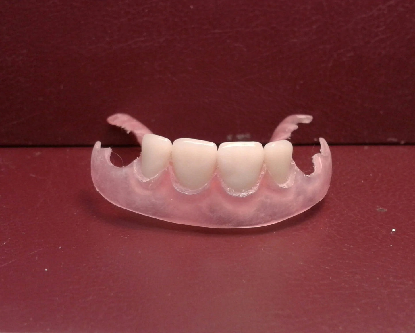 zUpper ultra-thin denture, Lower flexible partial, Bleach shade teeth, Wax try-in, New upper/lower impressions, shipping (x2) Balance Owed 2