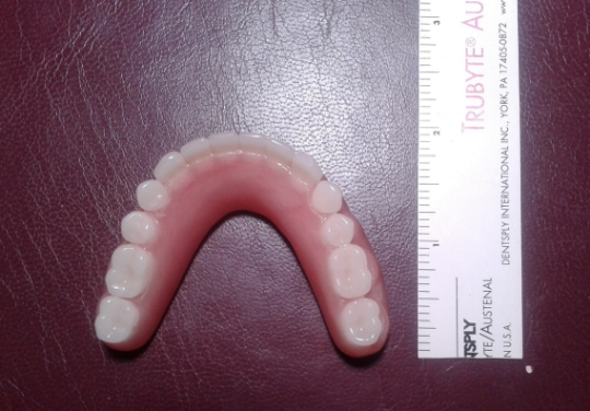 Set of acrylic dentures, large, bleach, false teeth