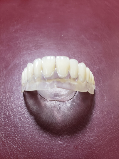 Set of Ultra-thin CLEAR dentures, false teeth