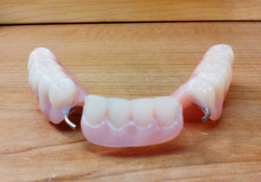 zAcrylic lower denture, Wax try-in, New Lower impression, Shipping (x2)