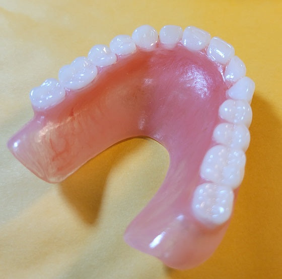 zUpper ultra-thin denture, Lower flexible partial, wax try-in, horseshoe palate, new upper/lower impressions, shipping (x2)