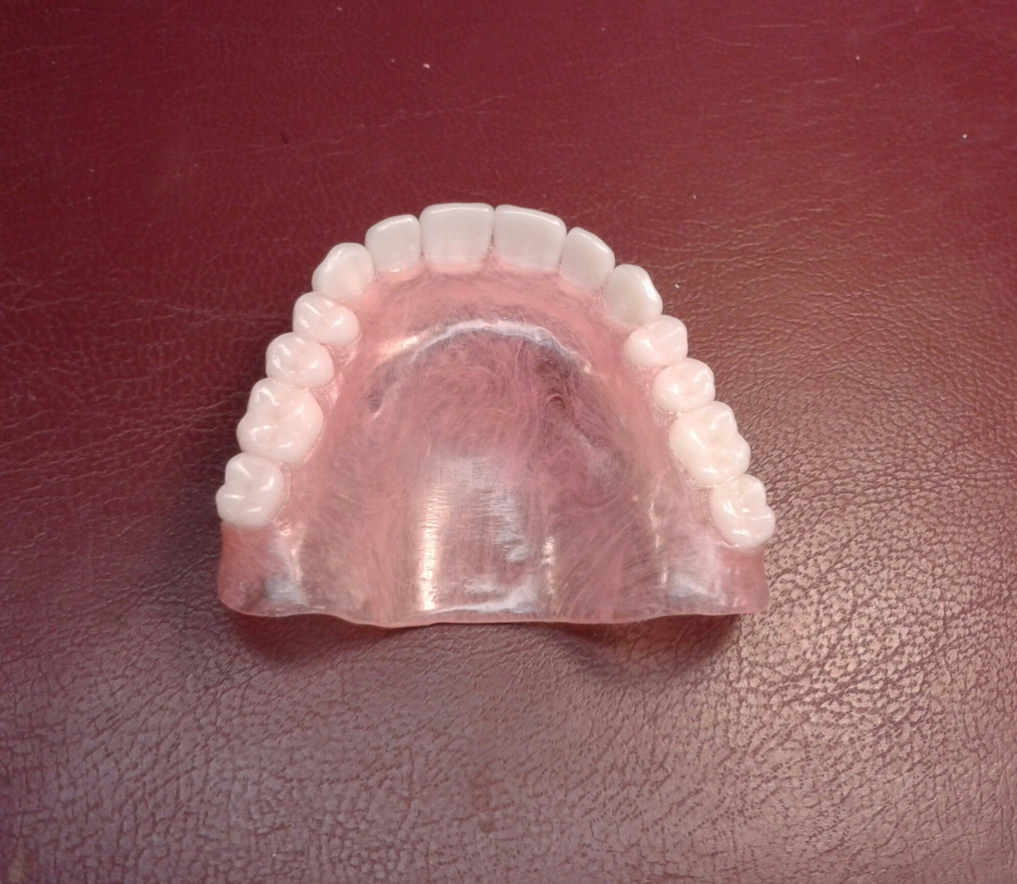 zUltra-thin upper denture, acrylic lower partial, horseshoe palate, wax try-in, shipping (x2), upper impression
