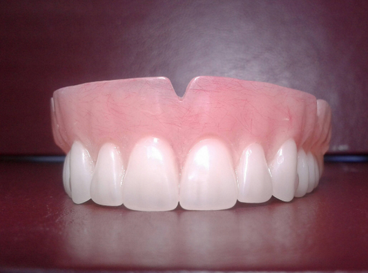 zupper acrylic denture, wax tryin, bleach shade, horseshoe palate, upper impression, shipping 2x, military discount