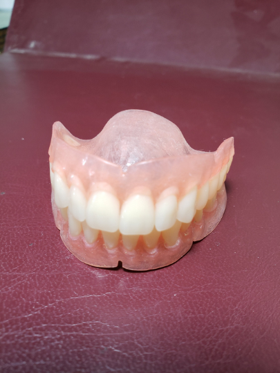 zLower ultra-thin denture, wax try-in, bleach shade premium teeth, upper impression, wax bite, shipping (x3), denture tooth repair, Dispaly denture credit