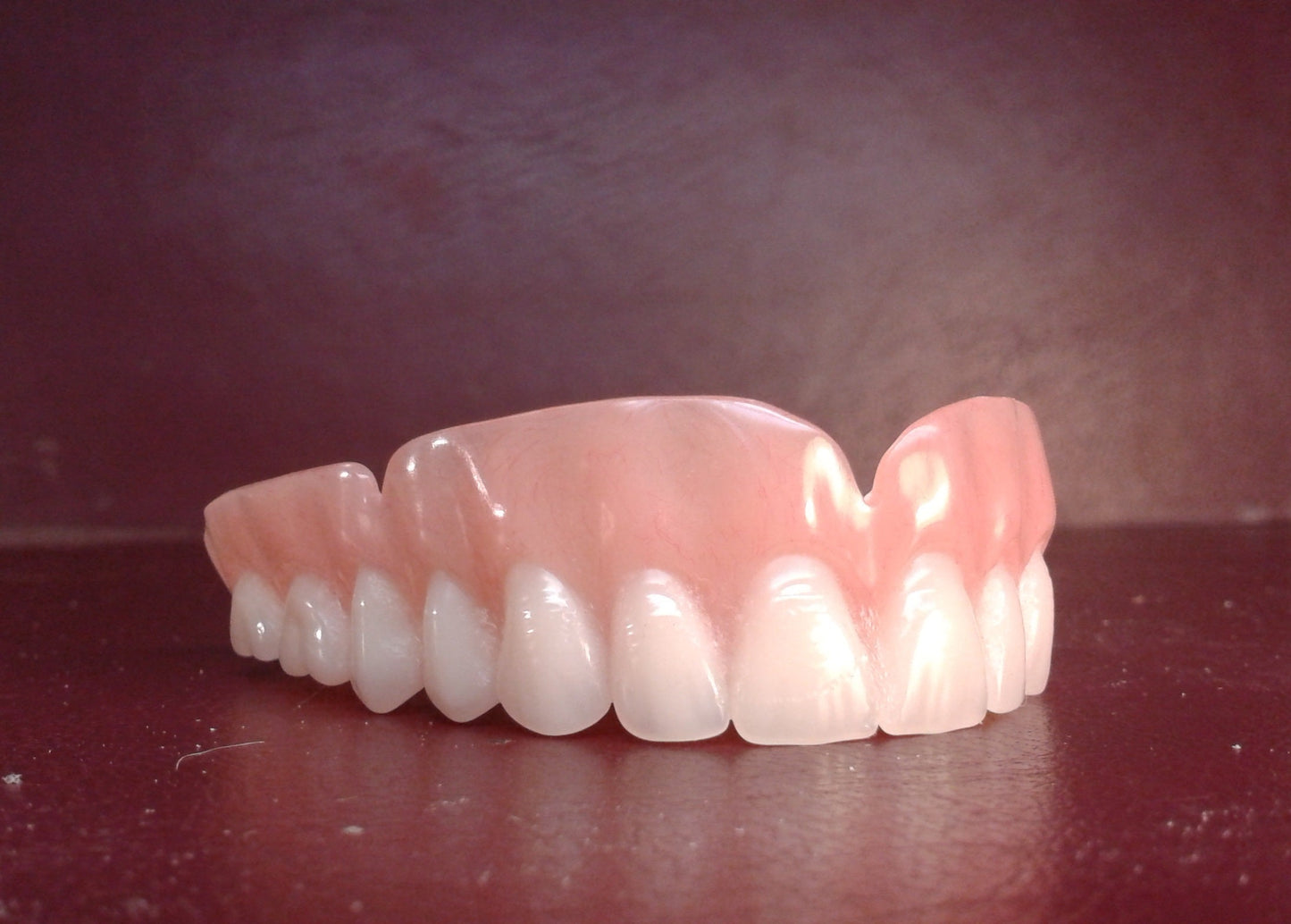 zAcrylic upper denture, wax try-in, upper impression, shipping (x2) (D ...