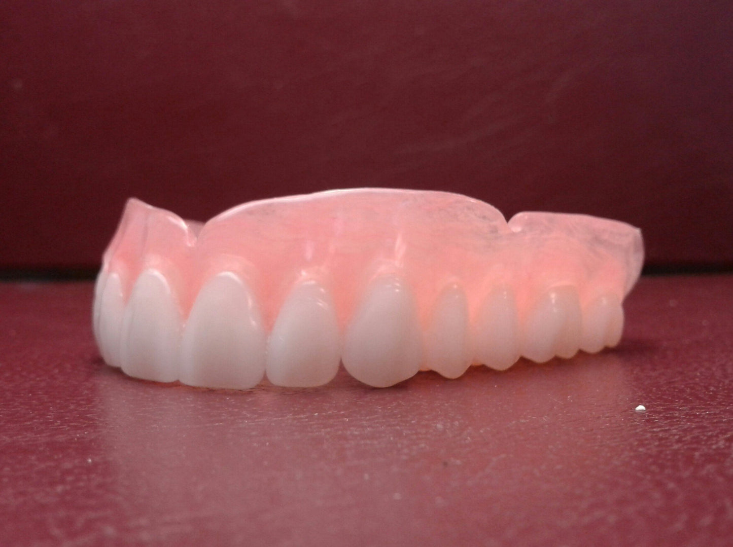 zUltra-thin upper denture, with horseshoe palate, wax try-in, shipping (x3) balance