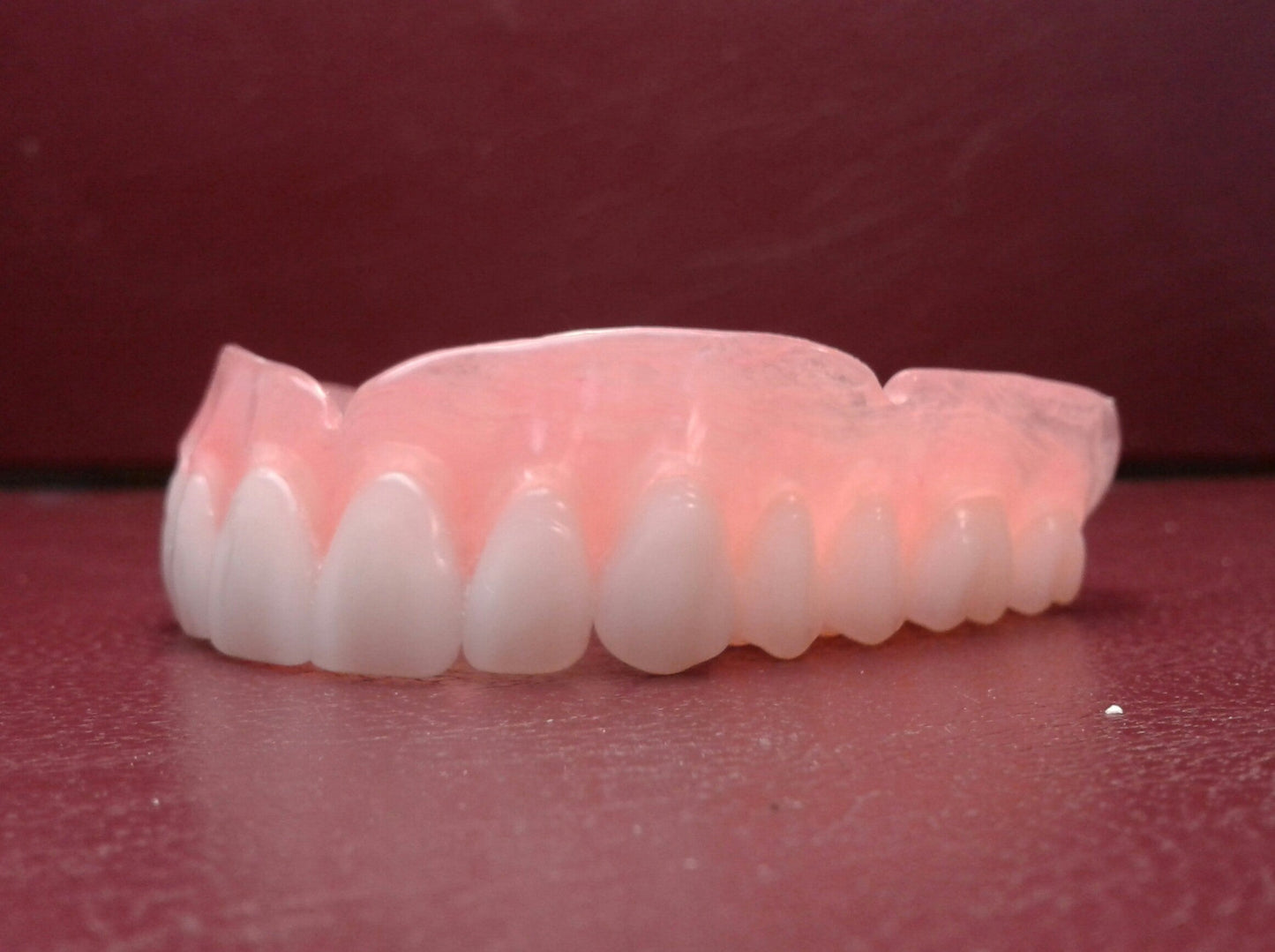 zUltra-thin upper denture, with horseshoe palate, lower acrylic partial, wax try-in, shipping (x2)