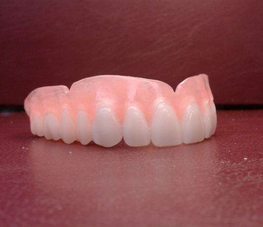 Ultra-thin upper denture, false teeth