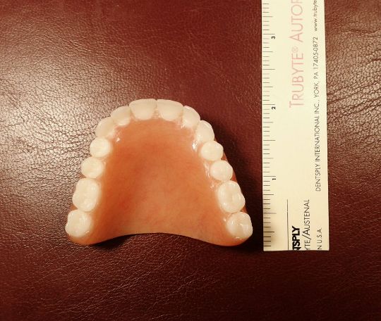 Upper acrylic denture, medium, bleach, false teeth