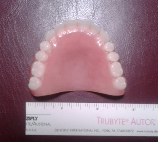 Upper acrylic denture, large, false teeth