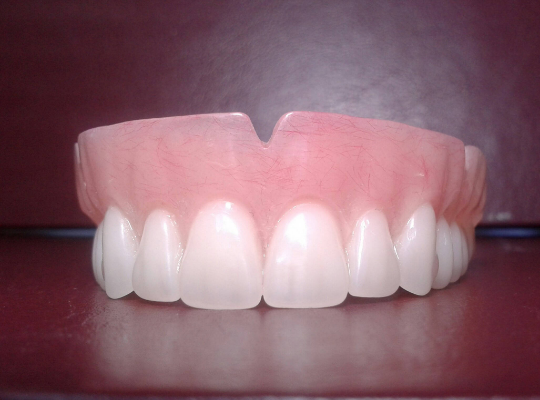 Upper acrylic denture, small, false teeth