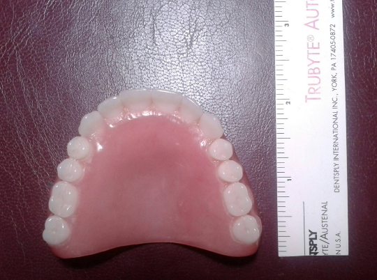 Upper acrylic denture, large, false teeth – Russell Klein Dentures