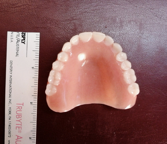 Upper acrylic denture, medium, false teeth – Russell Klein Dentures