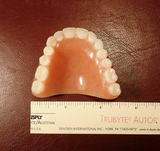 Upper acrylic denture, medium, bleach, false teeth – Russell Klein Dentures