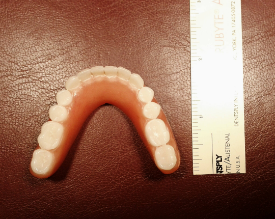 Lower denture acrylic, medium, bleach, false teeth