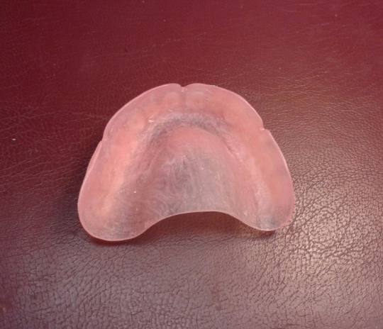 Ultra-thin upper denture, false teeth – Russell Klein Dentures
