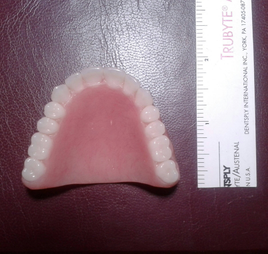 Upper acrylic denture, small, false teeth – Russell Klein Dentures