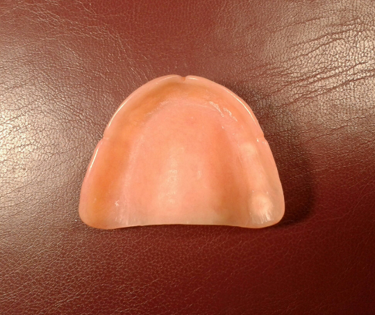 Upper acrylic denture, medium, bleach, false teeth – Russell Klein Dentures