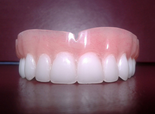 Upper acrylic denture, large, bleach, false teeth