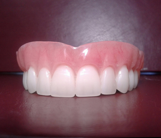 Upper acrylic denture, large, false teeth