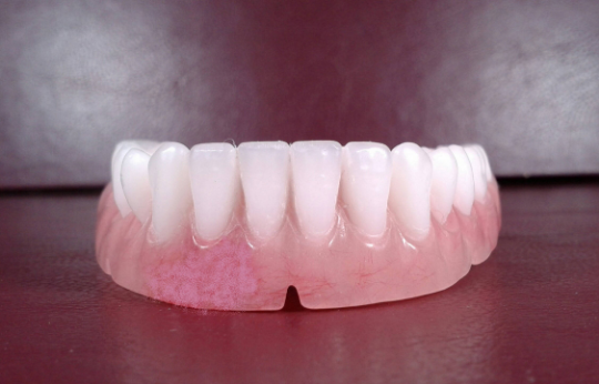 Lower denture acrylic, medium, bleach, false teeth