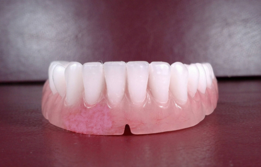 Lower denture acrylic, medium, bleach, false teeth