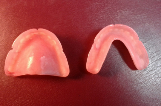 Set of acrylic dentures, small, false teeth