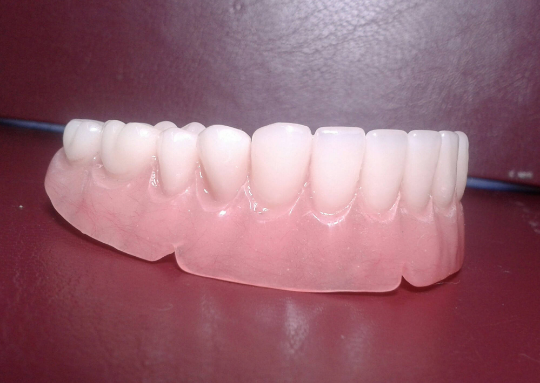 Lower denture acrylic, large, false teeth